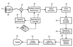 ULTRASONIC ACOUSTIC RADIATION FORCE EXCITATION FOR ULTRASONIC MATERIAL PROPERTY MEASUREMENT AND IMAGING