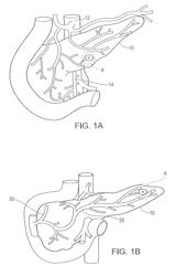 Method for separating desired cells from tissue by freezing