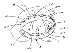 Hard Hat Cushioning Device