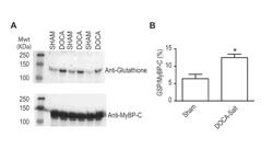 MYOSIN BINDING PROTEIN-C FOR USE IN METHODS RELATING TO DIASTOLIC HEART FAILURE