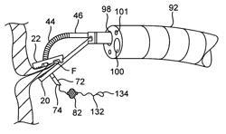 Methods and apparatus for securing and deploying tissue anchors