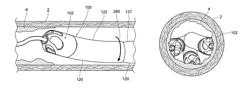 Atherectomy devices, systems, and methods