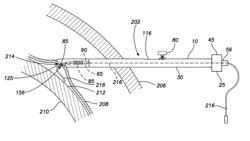 Apparatus and method for accessing an intrapericardial space