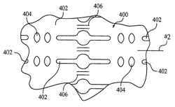 Flexible medical devices including metallic films