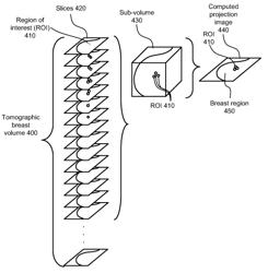 Computer-aided detection of regions of interest in tomographic breast imagery