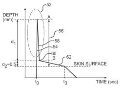 Method and device for the extraction of a body fluid