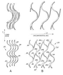 Endoluminal stent, self-supporting endoluminal graft and methods of making same