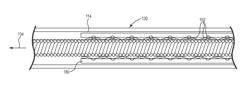 Lead with braided reinforcement