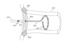 Systems and Methods for Noncontact Ablation