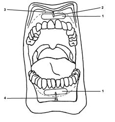 Gingival wafer