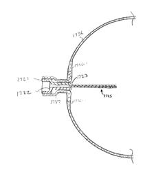 METHODS AND SYSTEMS FOR PERFORMING A MEDICAL PROCEDURE