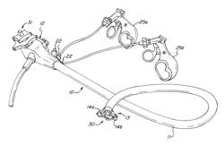 Surgical Method Utilizing Transluminal Endoscope and Instruments