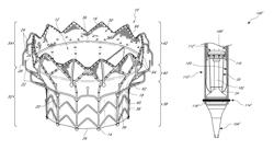 Replacement heart valves, delivery devices and methods