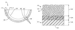 Orthopedic component of low stiffness