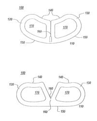 Spinal Fusion Implant