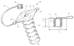 In-dwelling port for access into a body