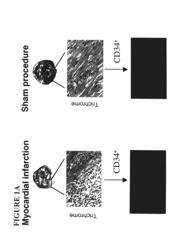 Regeneration of endogenous myocardial tissue