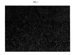 Film delivery system for tetrahydrolipstatin