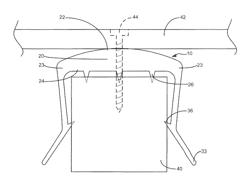 Shielding device and associated methods