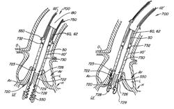 Everting heart valve