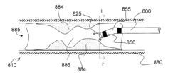 Systems and methods for analysis and treatment of an occluded body lumen