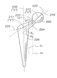 Anti-impingement femoral prostheses