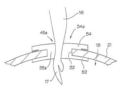 Surgical access apparatus and method