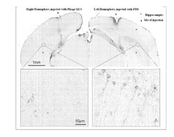 METHOD FOR TREATING NEURODEGENERATIVE TAUOPATHY