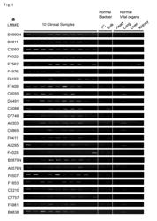 Method of screening compounds for treating bladder cancer