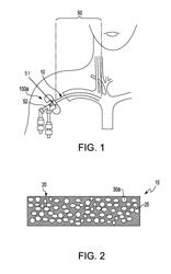 ACTIVE MATERIALS FOR PREVENTION AND TREATMENT OF FOULED SURFACES