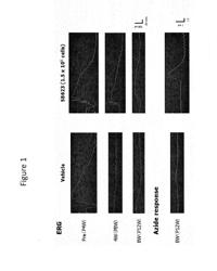 METHODS AND COMPOSITIONS FOR TREATMENT OF RETINAL DEGENERATION