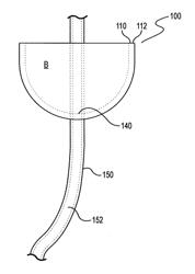 Device and method for illumination of vaginal fornix with ureter location, isolation and protection during hysterectomy procedure