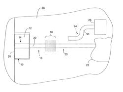 Reduction of Mode Hopping in a Laser Cavity