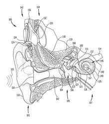 AUDIO PROCESSING PIPELINE FOR AUDITORY PROSTHESIS HAVING A COMMON, AND TWO OR MORE STIMULATOR-SPECIFIC, FREQUENCY-ANALYSIS STAGES