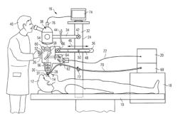 APPARATUS AND METHOD FOR EYE SURGERY