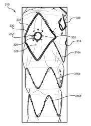 Prosthesis having pivoting fenestration