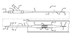 Catheter balloon and method for forming same