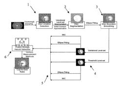 Automatic cup-to-disc ratio measurement system