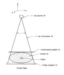 Matching geometry generation and display of mammograms and tomosynthesis images