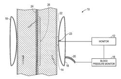 Pattern of cuff inflation and deflation for non-invasive blood pressure measurement