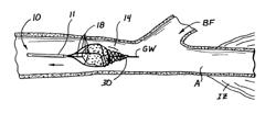 Embolectomy Catheters And Methods For Treating Stroke And Other Small Vessel Thromboembolic Disorders