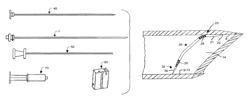 Biopsy needle system for obtaining a tissue biopsy specimen