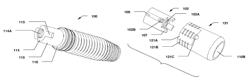 Dental implant system and method