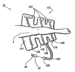 Garment detection method and system for delivering compression treatment