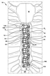 ORTHOPAEDIC FIXATION APPARATUS AND METHOD