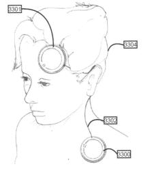 WEARABLE TRANSDERMAL ELECTRICAL STIMULATION DEVICES AND METHODS OF USING THEM