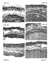 Soft tissue and bone augmentation and bulking utilizing muscle-derived progenitor cells, compositions and treatments thereof