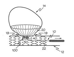 Device for closure of a vascular defect and method for treating the same