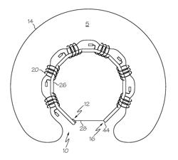 Corkscrew annuloplasty device