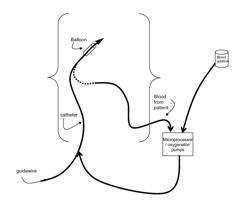 Method and Apparatus for Mitigating Acute Reoxygenation Injury During Percutaneous Coronary Intervention